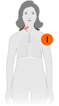estagio-1-lnh estagio-1-lnh