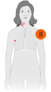 estagio-2-lnh estagio-2-lnh