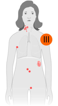 estagio-3-lnh estagio-3-lnh