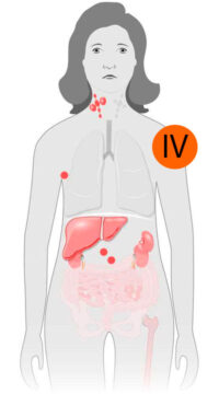 estagio-4-lnh estagio-4-lnh