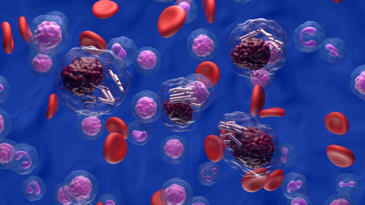 leucemia linfocítica crônica LLC